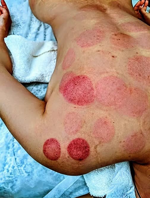 Western medicine combined with complementary therapies keeps me disciplined and proactive in managing lupus.