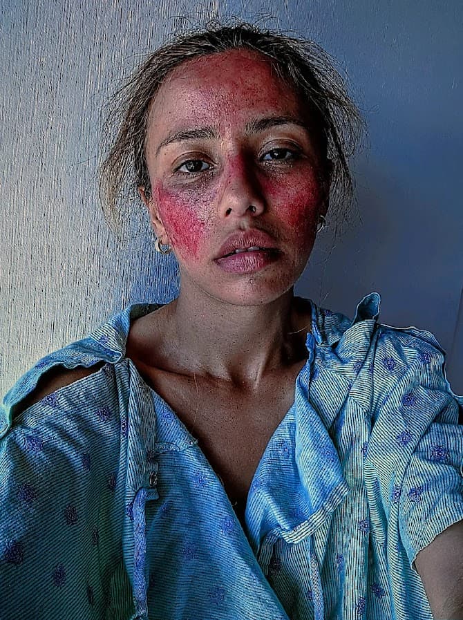 Each dialysis session and infusion is a lifeline. A reminder of how fragile life is.